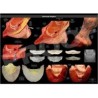 POSTER REGION NAVICULAR
