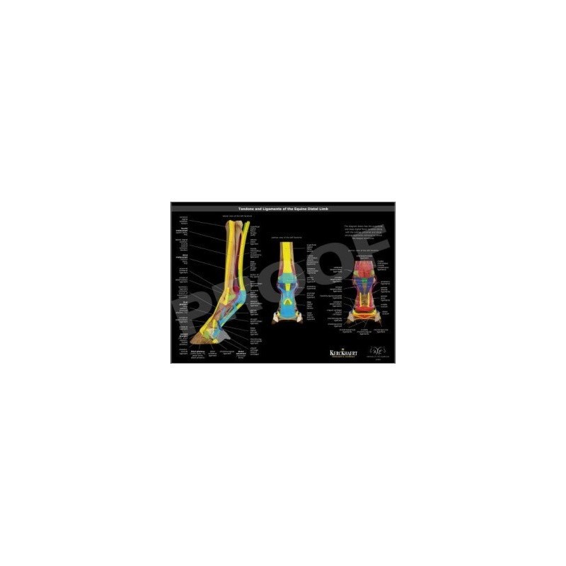 POSTER LIGAMENTOS Y TENDONES